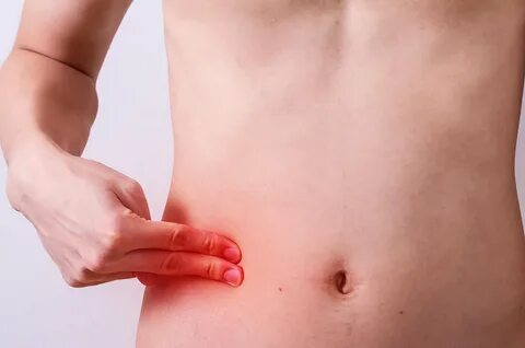 How to Treat and Prevent Appendicitis Naturally